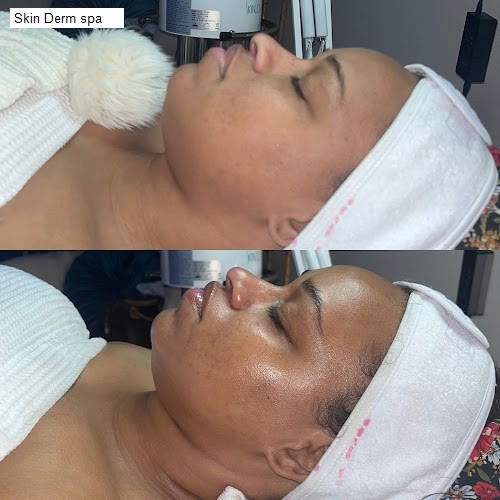 Skin Derm spa