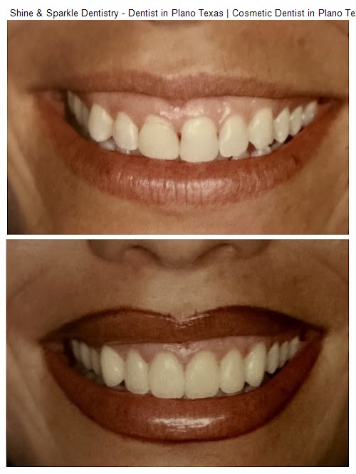 Shine & Sparkle Dentistry - Dentist in Plano Texas | Cosmetic Dentist in Plano Texas | Dentist in Plano Texas