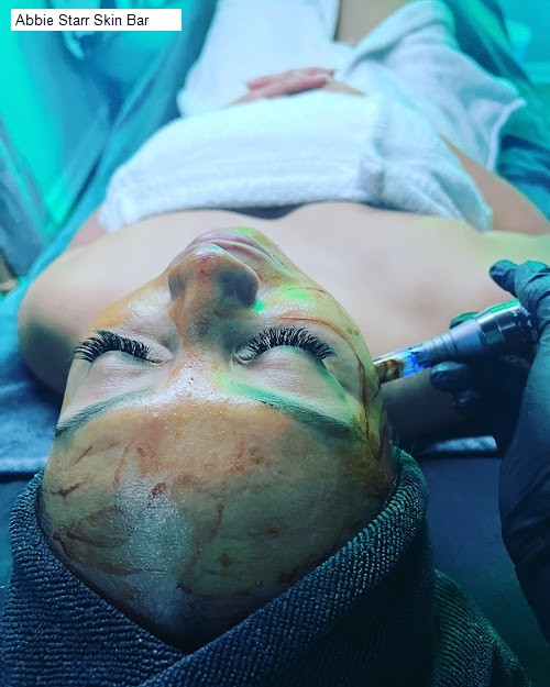 Abbie Starr Skin Bar